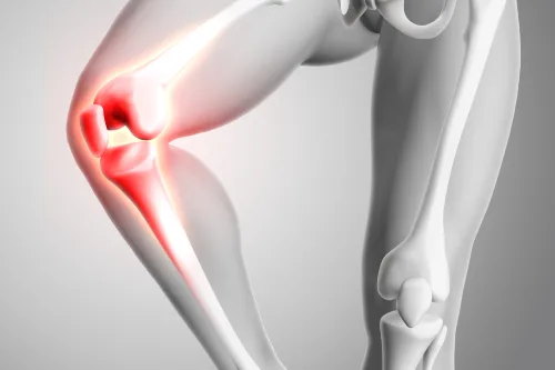 Abordaje médico integral para el control de la bursitis en Guadalajara